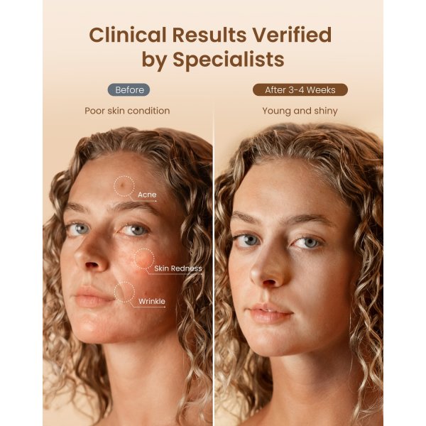 Artimis Blush Light Maske