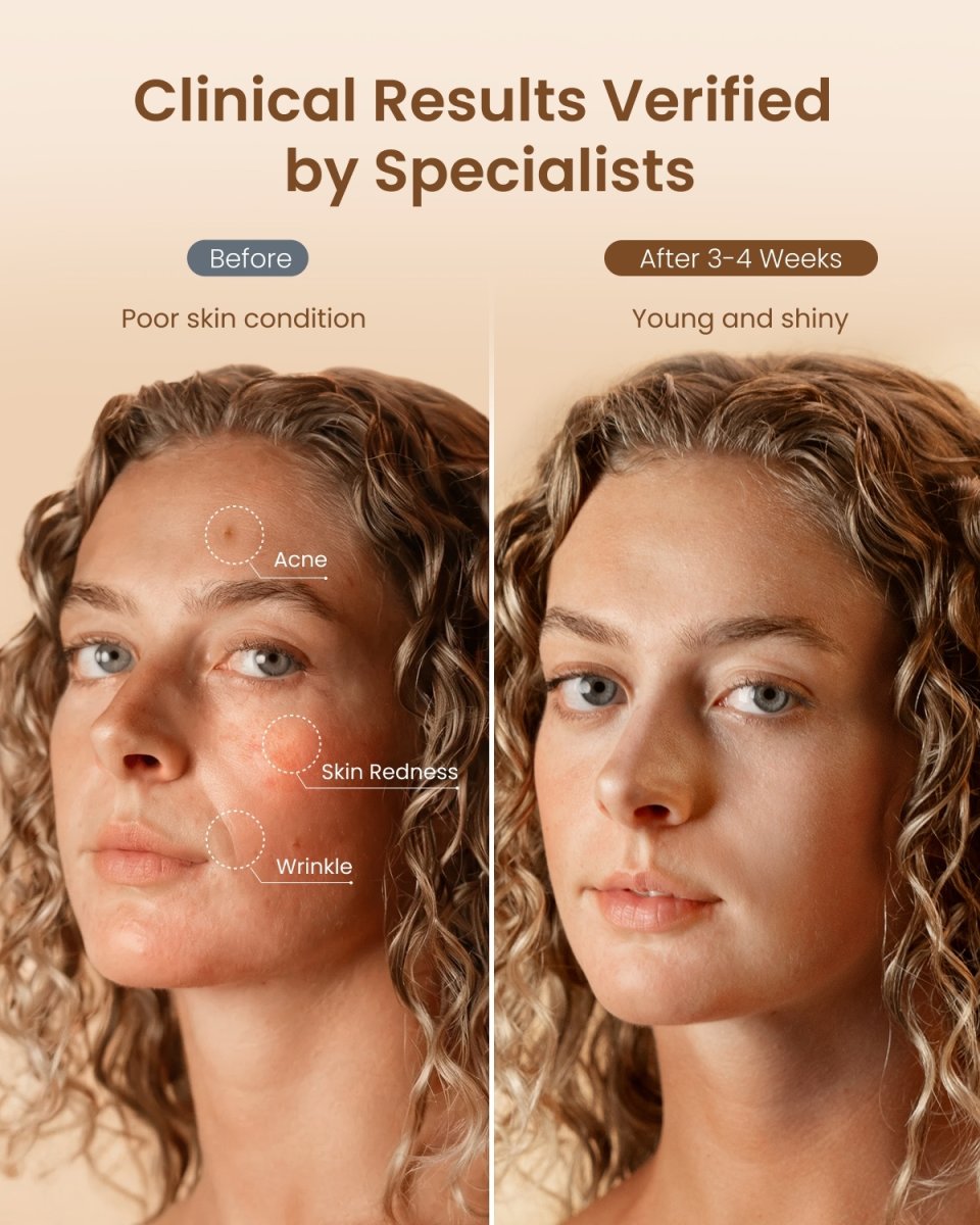 Artimis Blush Light Maske