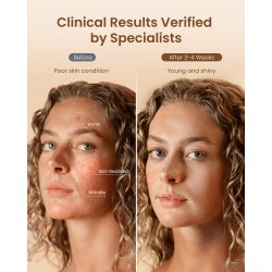 Artimis Blush Light Maske